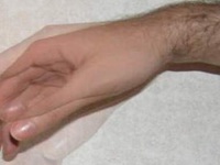 Тремор пальцев - причины и лечение