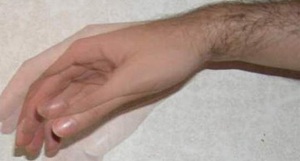 Тремор пальцев - причины и лечение