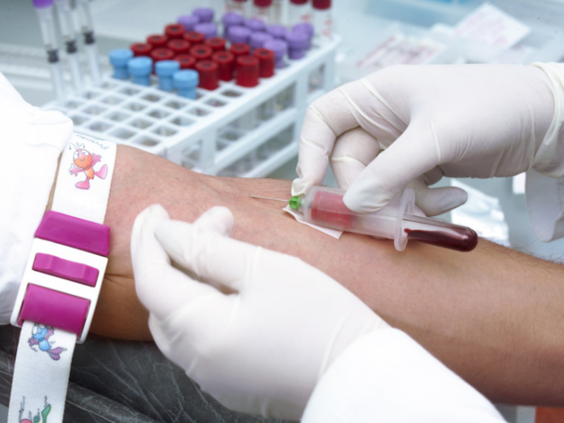 Биохимический анализ крови - обязательное исследование